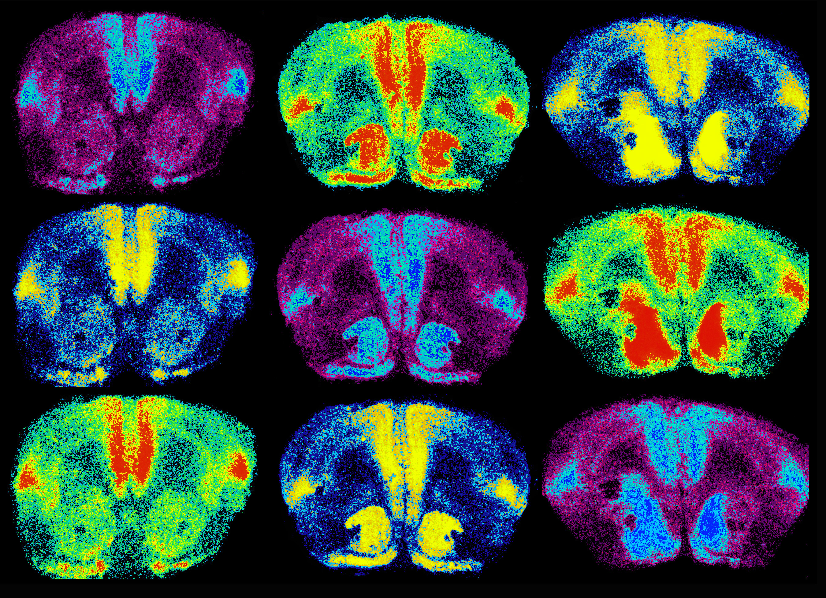 Conte Center For Oxytocin And Social Cognition